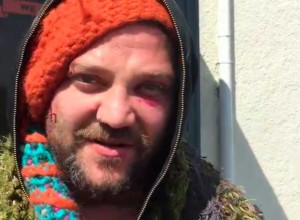 Se la dieron: un grupo de rap islandés le rompió la cara a piñas Bam Margera