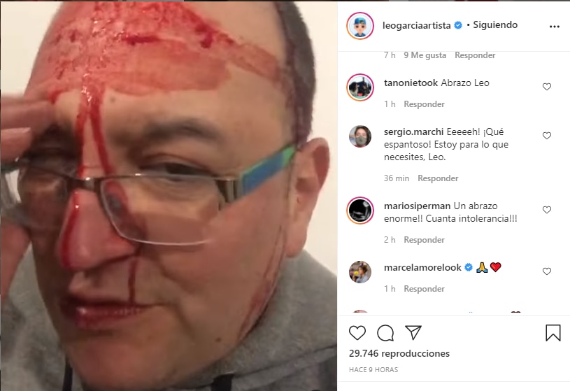 Leo García denunció una golpiza homofóbica (Foto: Instagram).