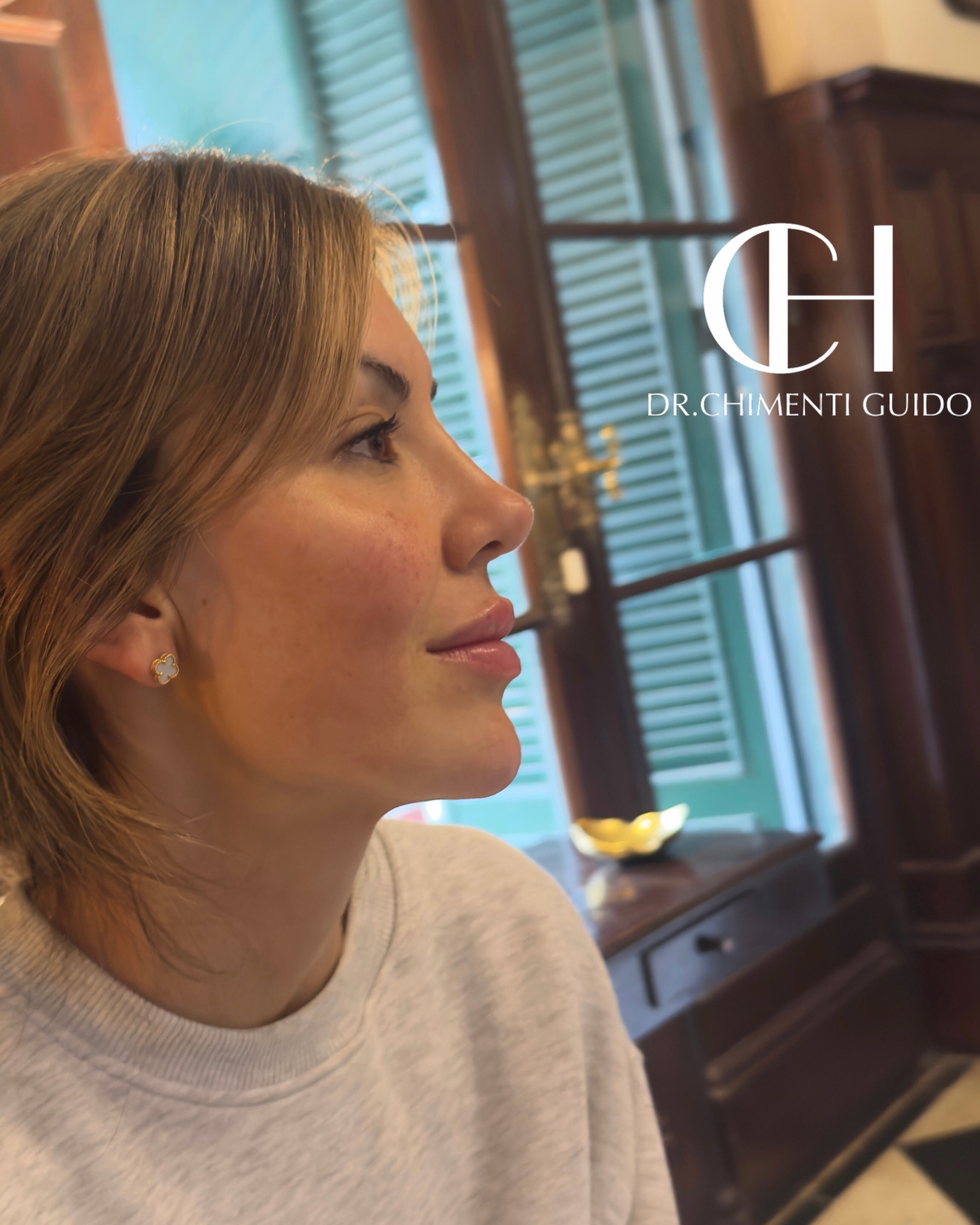 La esposa de Lisandro Martínez, Muriel López Benítez, se hizo un retoque estético y lo compartió en redes sociales. (Foto: dr.chimentiguido/IG)