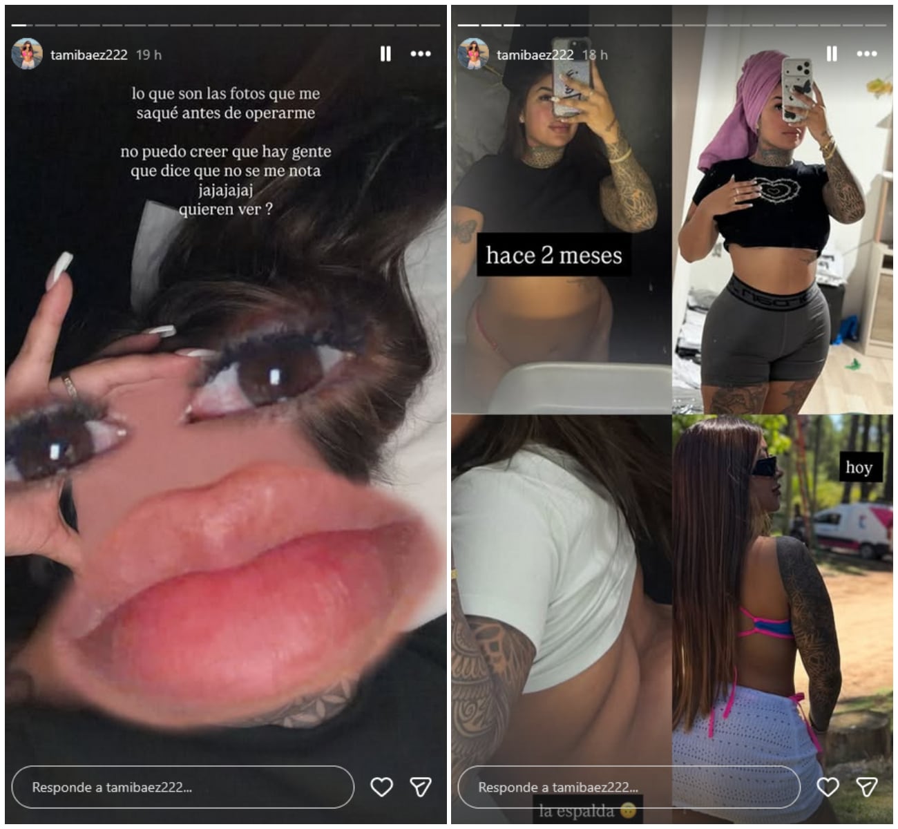 Tamara Báez se había hecho una liposucción en octubre del 2025. (Foto: Instagram / tamarabaez222)